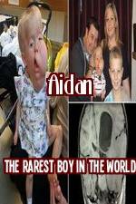 Watch Aidan The Rarest Boy In The World Vidbull