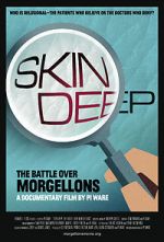 Watch Skin Deep: The Battle Over Morgellons Vidbull