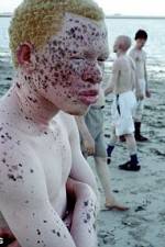 Watch Albino United Vidbull