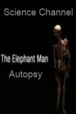 Watch Science Channel Elephant Man Autopsy Vidbull