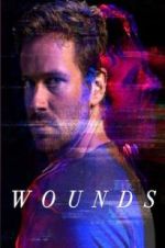 Watch Wounds Vidbull