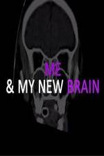 Watch Me & My New Brain Vidbull