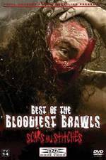 Watch TNA Wrestling: Best of the Bloodiest Brawls - Scars and Stitches Vidbull