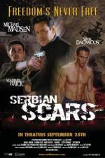 Watch Serbian Scars Vidbull