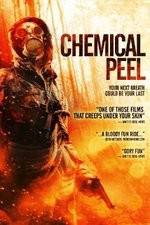 Watch Chemical Peel Vidbull