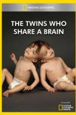 Watch National Geographic The Twins Who Share A Brain Vidbull