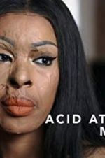 Watch Acid Attack: My Story Vidbull