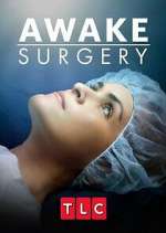 Watch Awake Surgery Vidbull